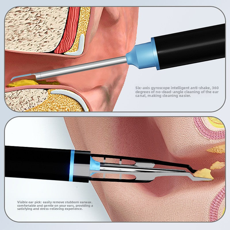 Visual Earwax Removal Kit